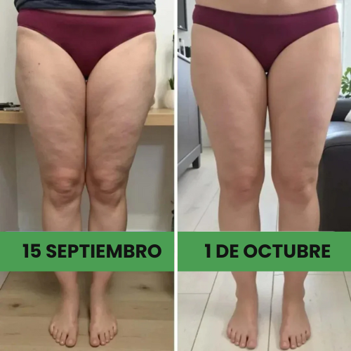 Leggings anticelulíticos[compra 1 y llévate2]