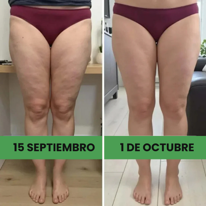 Leggings anticelulíticos[compra 1 y llévate2]